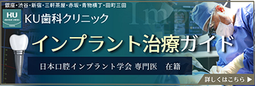 インプラント治療ガイド